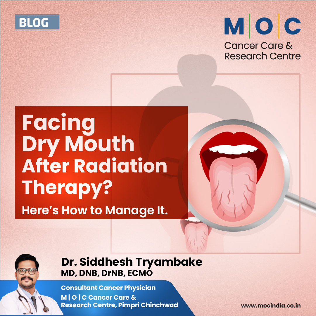 Dealing with mouth dryness after radiation therapy for head and neck cancer